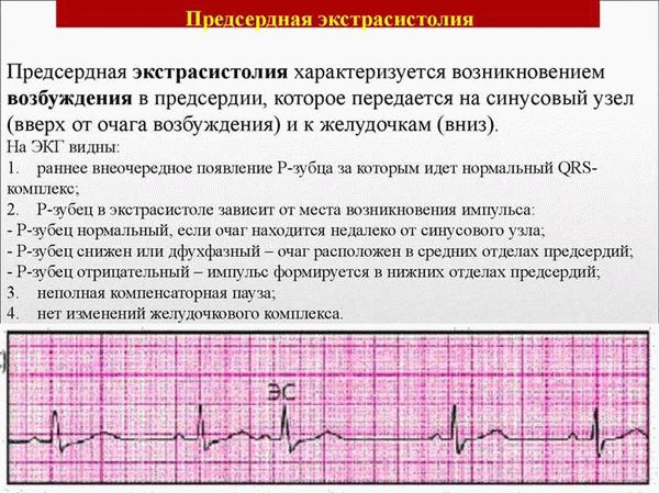 Призывают ли с синусовой аритмией в 2024 году