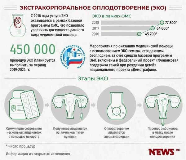 Инструкция по получению ЭКО по ОМС